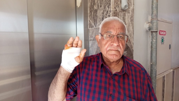 Komşu dehşeti: Isırık, parmağın kesilmesine yol açtı 1