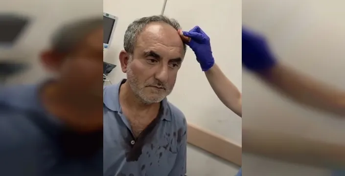 Samandağ'da ekoloji grubu sözcüsüne saldırı