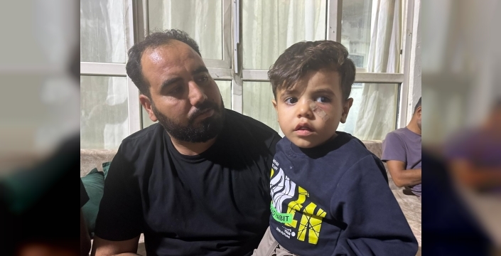 Akçakale'de oyun oynarken yorgun mermi gözüne isabet eden çocuk yaralandı