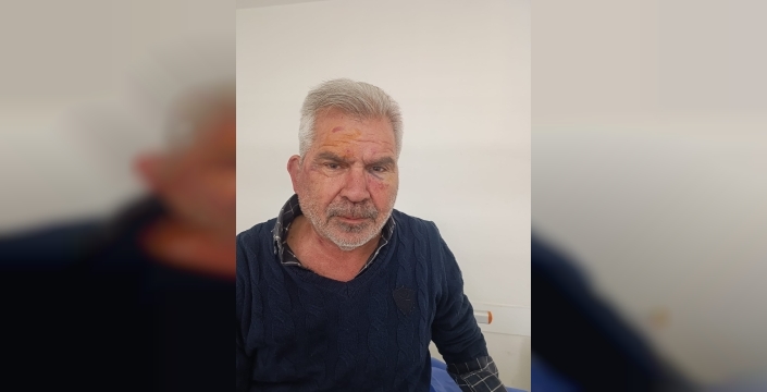 Şok saldırı Mersin'de: Taksi şoförü bıçaklanıp yaralandı, 2 şüpheli tutuklandı!