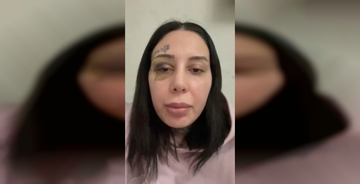 Hamile olduğunu bildiği eşi tarafından darbedildi, başına silah dayandı: 'Seni öldüreceğim