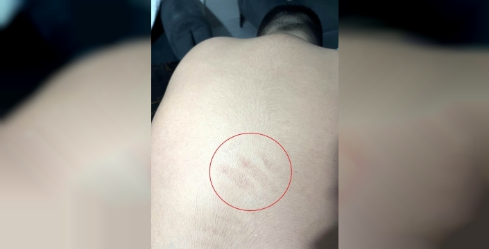 Otizmli öğrenciye darp iddiası: Aile şikayette bulundu