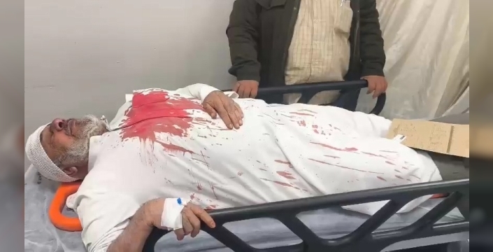 Şanlıurfa'da sopayla darbedilen Mehmet Sayım'a 4 tutuklama