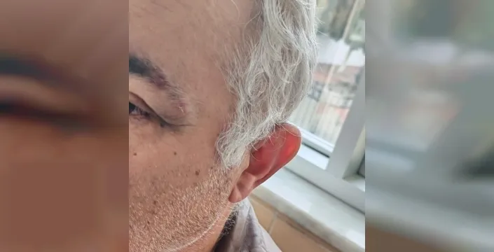 Konya'da şok edici olay: Aile hekimini darbeden müezzin, savcılığın itirazıyla tutuklandı