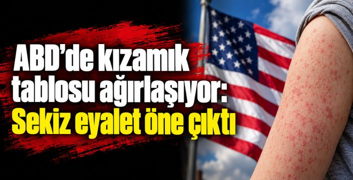 ABD’de kızamık vakalarında büyük artış: Sayı 4 bini geçti